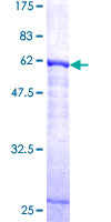 ab158235 on a 12.5% SDS-PAGE stained with Coomassie Blue.