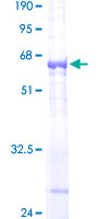 ab158237 on a 12.5% SDS-PAGE stained with Coomassie Blue.