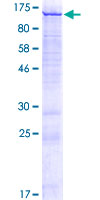 ab165120 on a 12.5% SDS-PAGE stained with Coomassie Blue.