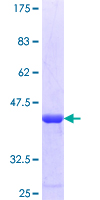 ab165121 on a 12.5% SDS-PAGE stained with Coomassie Blue.