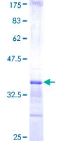 ab160541 on a 12.5% SDS-PAGE stained with Coomassie Blue.