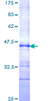 ab153514 on a 12.5% SDS-PAGE stained with Coomassie Blue.