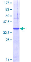 ab165554 on a 12.5% SDS-PAGE stained with Coomassie Blue.