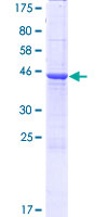 ab165469 on a 12.5% SDS-PAGE stained with Coomassie Blue.