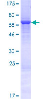 ab163262 on a 12.5% SDS-PAGE stained with Coomassie Blue.