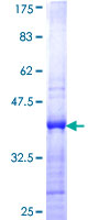 ab153555 on a 12.5% SDS-PAGE stained with Coomassie Blue.