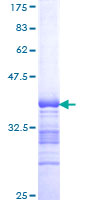 ab153556 on a 12.5% SDS-PAGE stained with Coomassie Blue.