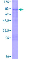 ab163535 on a 12.5% SDS-PAGE stained with Coomassie Blue.