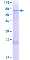 ab164341 on a 12.5% SDS-PAGE stained with Coomassie Blue.