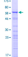 ab166262 on a 12.5% SDS-PAGE stained with Coomassie Blue.