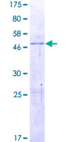 ab165553 on a 12.5% SDS-PAGE stained with Coomassie Blue.