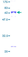 ab158038 on a 12.5% SDS-PAGE stained with Coomassie Blue.