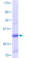 ab158039 on a 12.5% SDS-PAGE stained with Coomassie Blue.