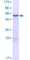 ab166412 on a 12.5% SDS-PAGE stained with Coomassie Blue.