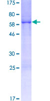 ab162253 on a 12.5% SDS-PAGE stained with Coomassie Blue.