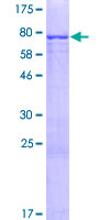 ab165950 on a 12.5% SDS-PAGE stained with Coomassie Blue.
