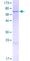 ab162209 on a 12.5% SDS-PAGE stained with Coomassie Blue.