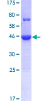 ab165604 on a 12.5% SDS-PAGE stained with Coomassie Blue.