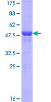 ab165636 on a 12.5% SDS-PAGE stained with Coomassie Blue.