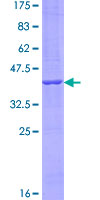 ab164836 on a 12.5% SDS-PAGE stained with Coomassie Blue.