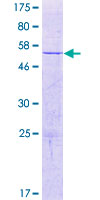 ab165373 on a 12.5% SDS-PAGE stained with Coomassie Blue.