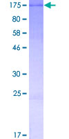 ab163614 on a 12.5% SDS-PAGE stained with Coomassie Blue.