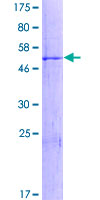 ab165338 on a 12.5% SDS-PAGE stained with Coomassie Blue.
