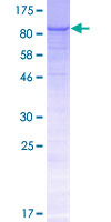 ab164196 on a 12.5% SDS-PAGE stained with Coomassie Blue.