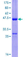 ab161831 on a 12.5% SDS-PAGE stained with Coomassie Blue.