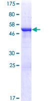 ab163986 on a 12.5% SDS-PAGE stained with Coomassie Blue.