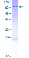 ab165168 on a 12.5% SDS-PAGE stained with Coomassie Blue.