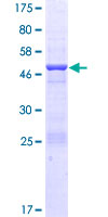 ab165876 on a 12.5% SDS-PAGE stained with Coomassie Blue.