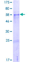 ab164638 on a 12.5% SDS-PAGE stained with Coomassie Blue.