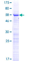 ab162212 on a 12.5% SDS-PAGE stained with Coomassie Blue.
