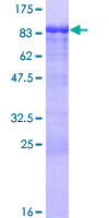 ab159931 on a 12.5% SDS-PAGE stained with Coomassie Blue.
