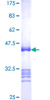 ab159932 on a 12.5% SDS-PAGE stained with Coomassie Blue.