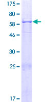 ab164257 on a 12.5% SDS-PAGE stained with Coomassie Blue.
