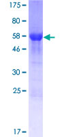 ab161899 on a 12.5% SDS-PAGE stained with Coomassie Blue.