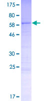 ab164853 on a 12.5% SDS-PAGE stained with Coomassie Blue.