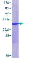 ab161238 on a 12.5% SDS-PAGE stained with Coomassie Blue.