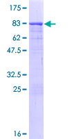 ab163055 on a 12.5% SDS-PAGE stained with Coomassie Blue.