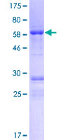 ab164223 on a 12.5% SDS-PAGE stained with Coomassie Blue.