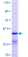 ab161699 on a 12.5% SDS-PAGE stained with Coomassie Blue.