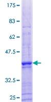 ab164051 on a 12.5% SDS-PAGE stained with Coomassie Blue.
