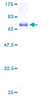 ab160205 on a 12.5% SDS-PAGE stained with Coomassie Blue.