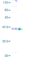 ab163463 on a 12.5% SDS-PAGE stained with Coomassie Blue.