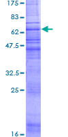 ab162591 on a 12.5% SDS-PAGE stained with Coomassie Blue.