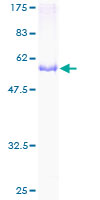ab161683 on a 12.5% SDS-PAGE stained with Coomassie Blue.