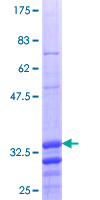 ab161684 on a 12.5% SDS-PAGE stained with Coomassie Blue.