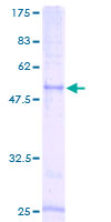 ab152942 on a 12.5% SDS-PAGE stained with Coomassie Blue.